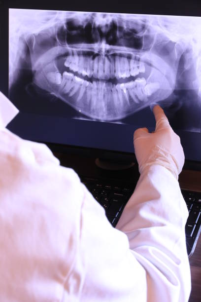 Best Emergency Tooth Extraction in New Baltimore, MI
