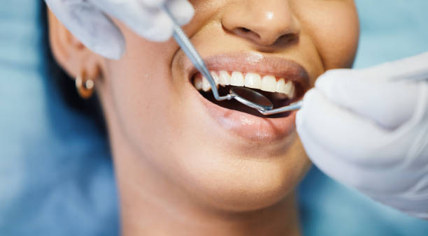 Best Urgent Care for Lost Fillings or Crowns in New Baltimore, MI