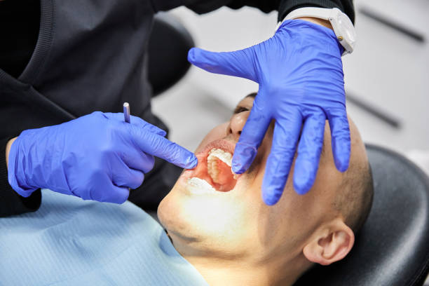 Best Emergency Treatment for Dental Infections or Abscesses in New Baltimore, MI