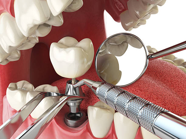 Best Same-Day Emergency Dental Services in New Baltimore, MI